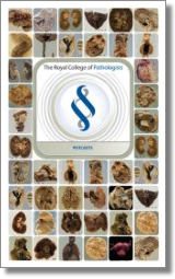 The Royal College of Pathologists POTcast website logo